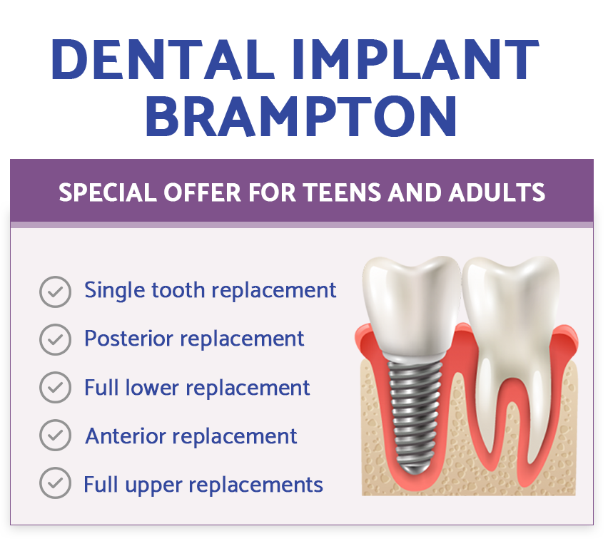 Dental Bonding Brampton
