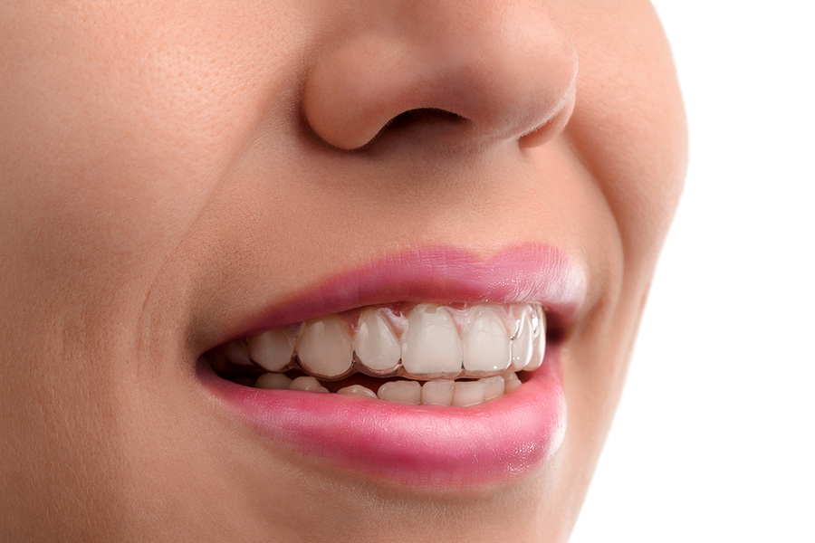 Dentist Brampton Dentist Brampton