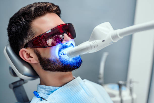 teethwhiteningstock-2 Close up view of man undergoing laser tooth whitening treatment to remove stains and discoloration.