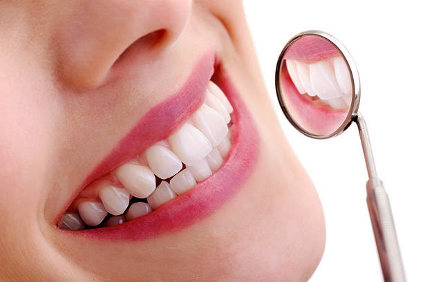 Beautiful smiling model with dental mirror- XXXL Image Beautiful smiling model with dental mirror- XXXL Image
