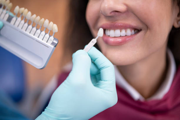 teethwhiteningstock-5 Dentist uses a palette tooth color sample to determine shade of patient's teeth.